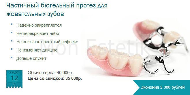 Бюгельный протез на один зуб верхний Бюгельный протез на один зуб верхний