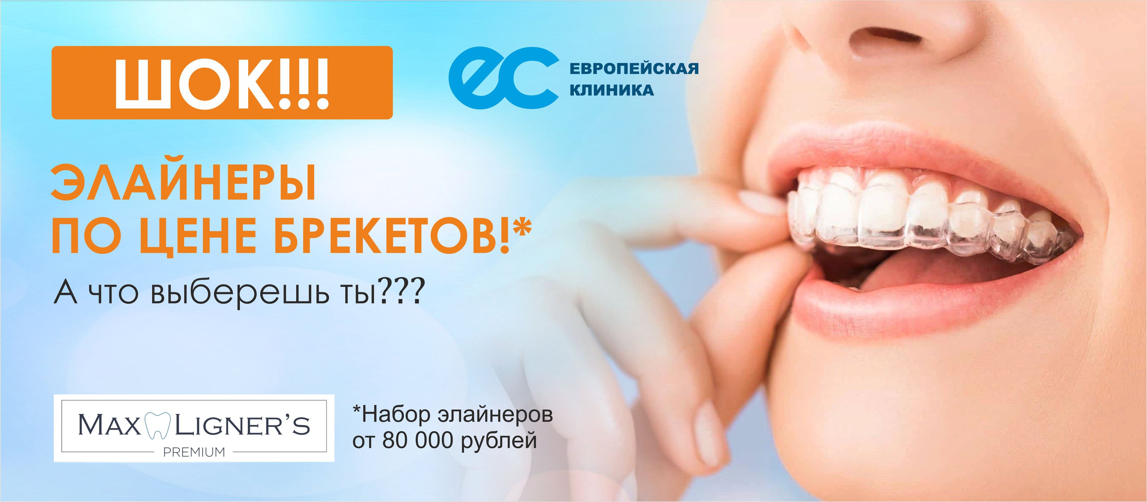 Элайнеры Череповец Стоимость