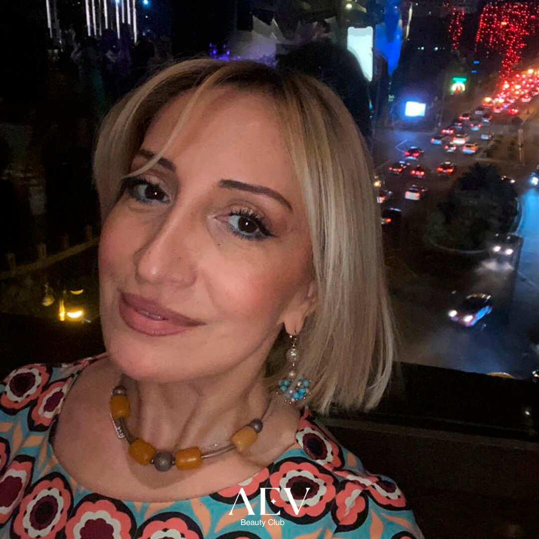 Чимназ Алиева