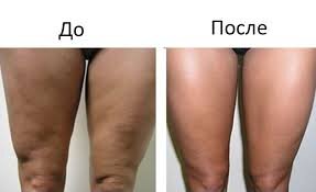 Александр Аникин