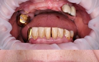 фотография работы врача Сергея Геннадьевича Локтионова