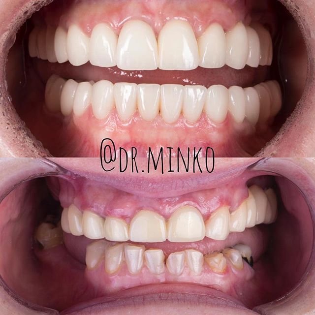 фотография работы Стоматологической клиники Доктор Минко