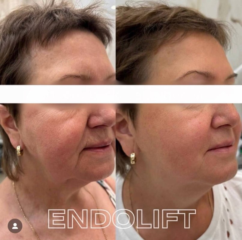 фотография работы Клиники современной косметологии Esteeskin Clinic