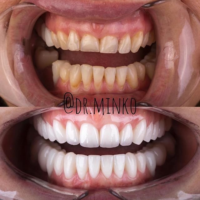 фотография работы Стоматологической клиники Доктор Минко