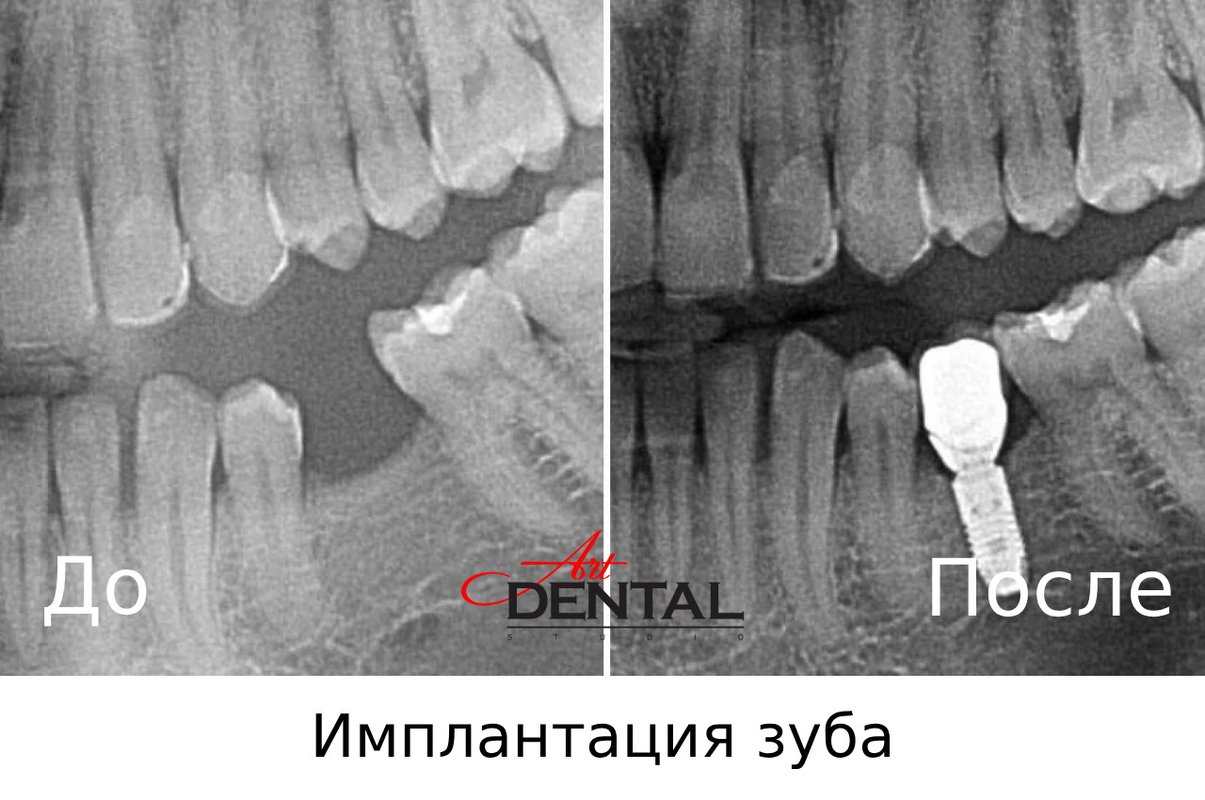 фотография работы Стоматологии Art Dental Studio на улице Маршала Тухачевского, 58 к 3