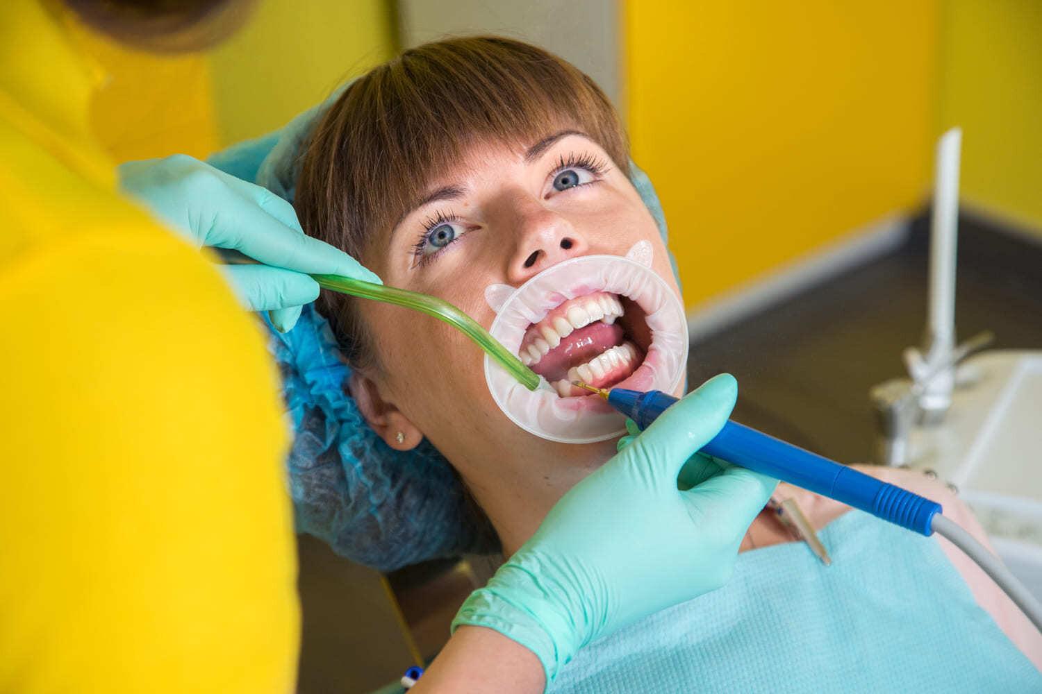 Профессиональная чистка зубов у стоматолога. Профессиональная гигиена полости рта. Гигиена зубов в стоматологии.