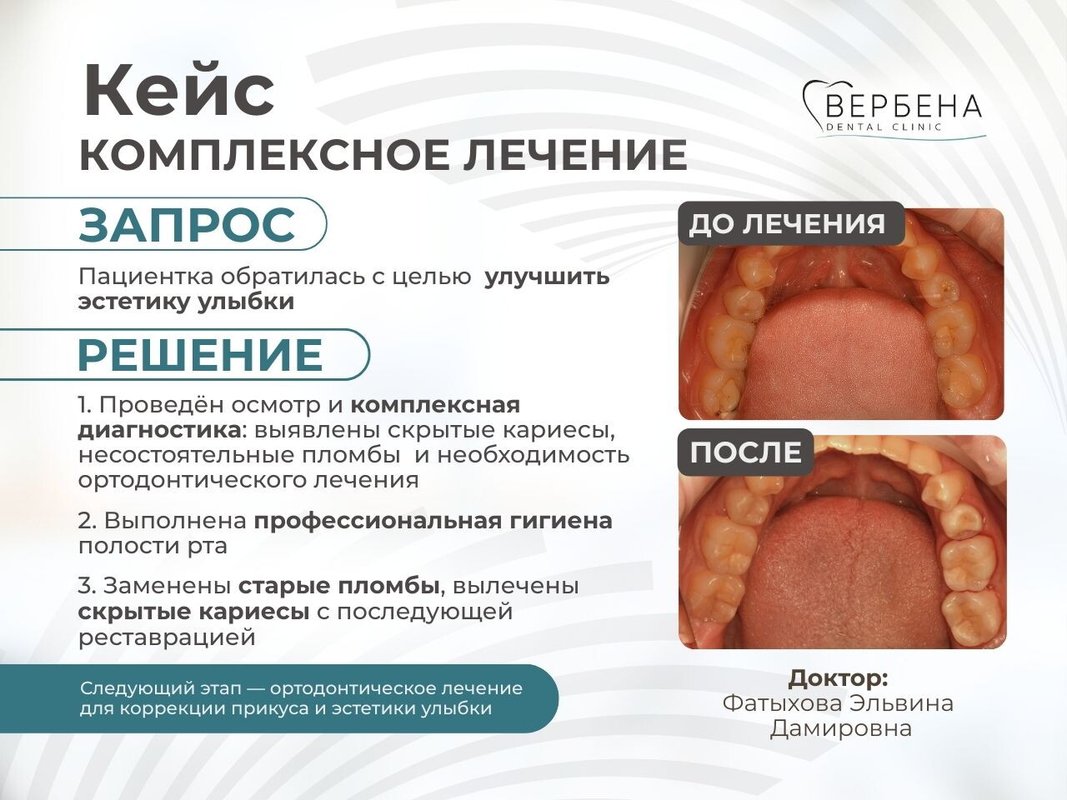фотография работы Стоматологии Вербена на улице Рихарда Зорге