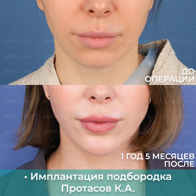 фотография работы Клиники пластической хирургии и косметологии Абриелль в Василеостровском районе