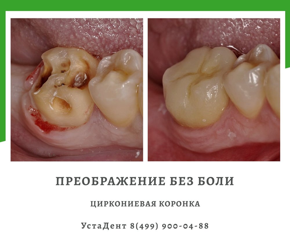 фотография работы Стоматологии УстаДент на метро Яхромская