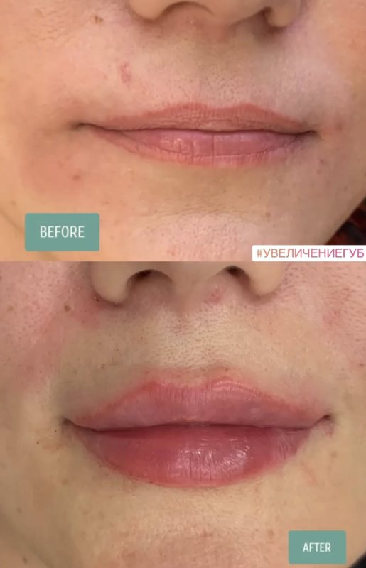 фотография работы Косметологической клиники Beautique Clinic на 1-й Брестской улице
