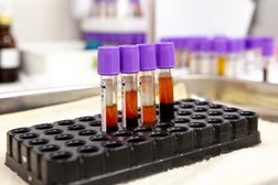 Медицинская лаборатория Моя Наука, с рейтингом 3.9 - находится по адресу Самара, улица Высоцкого, 8 