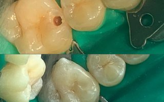 фотография работы врача Варвары Геннадьевны Халтуриной