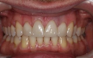 фотография работы врача Сергея Анатольевича Лабаня