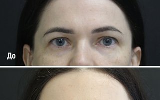 фотография работы врача Валерия Геннадьевича Золотых