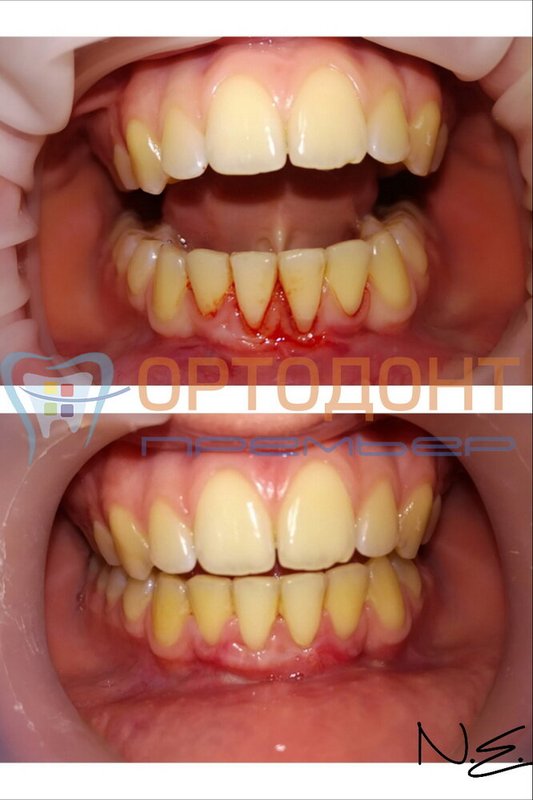 фотография работы Клиники эстетической стоматологии и косметологии Артукова на проспекте Мира