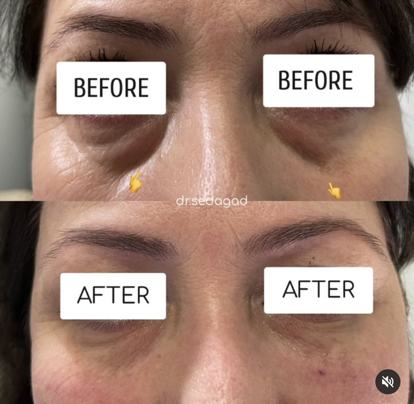 фотография работы Косметологической клиники Beautique Clinic на 1-й Брестской улице