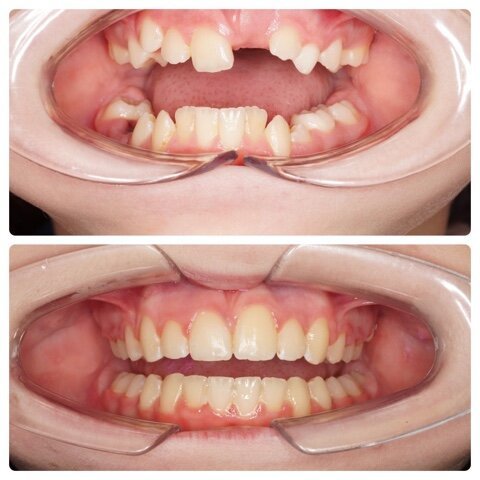 фотография работы Стоматологической клиники DENTBLANC на Мичуринском проспекте