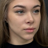 фото от пользователя Анастасия в отзыве о клинике Персона на Большой Печерской улице