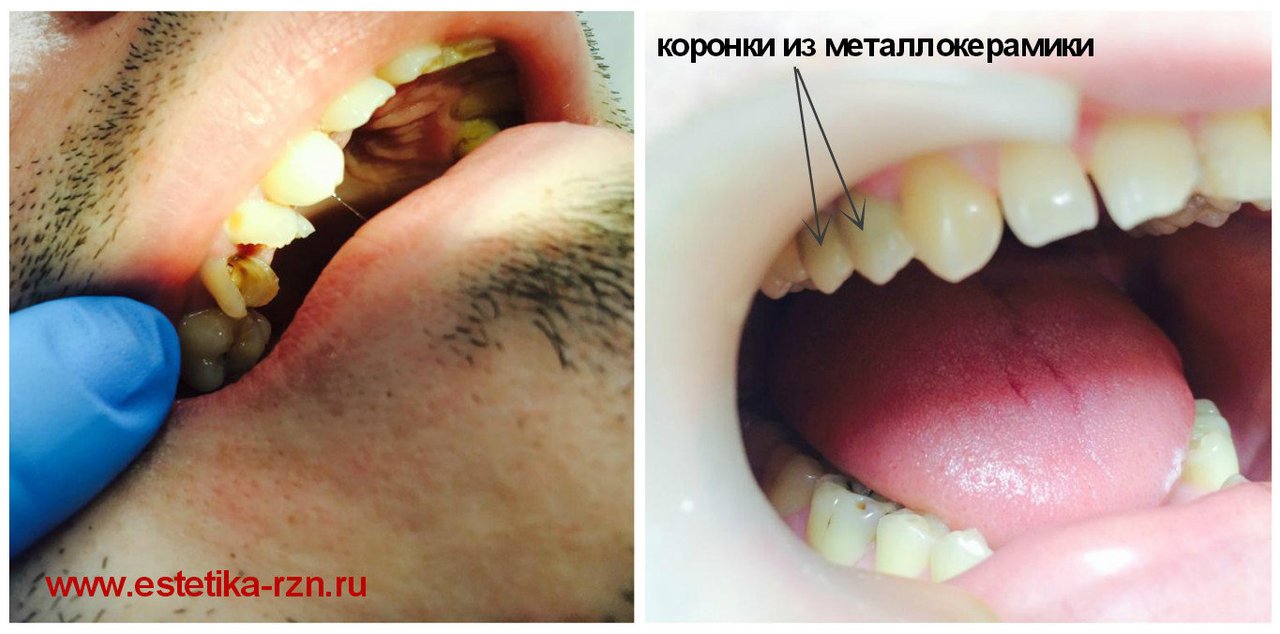 фотография работы Стоматологической клиники Меди Лайт на Татарской улице