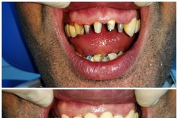 Стоматологическая клиника С-Клиник, с рейтингом 3.2 - находится по адресу Московская область, Химки, улица Энгельса, 27 