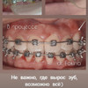 фото от пользователя Дарья в отзыве о стоматологической клинике Super Smile на метро Удельная