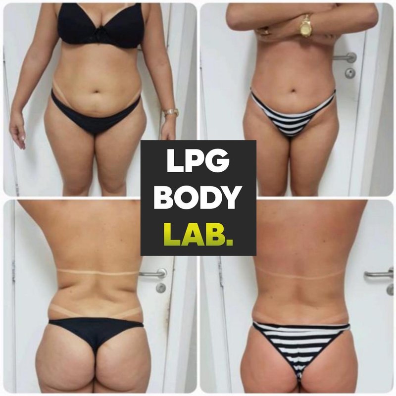 Сибирское здоровье крем от целлюлита. Боди лаб павелецкий. Разработка сайта bodylab. Боди лаб павелецкий. Бодилаб.