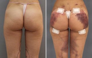 фотография работы врача Марины Анатольевны Четвериковой