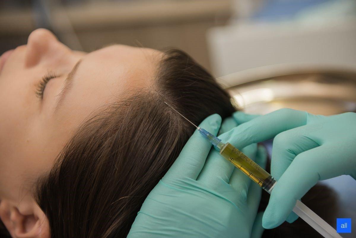 Что такое микротоковая терапия волосистой части головы