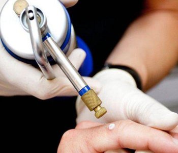 Родинки и их удаление в онкологическом диспансере