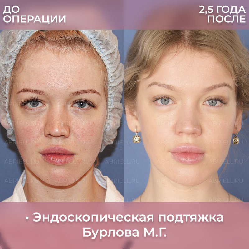 фотография работы Клиники пластической хирургии и косметологии Абриелль в Василеостровском районе
