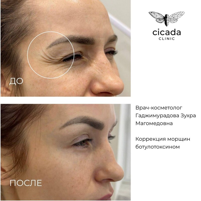 фотография работы Клиники инновационной косметологии Cicada Clinic