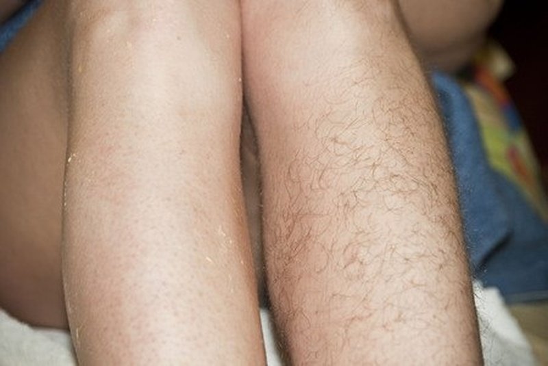 Как долго не растут волосы на ногах после бритья