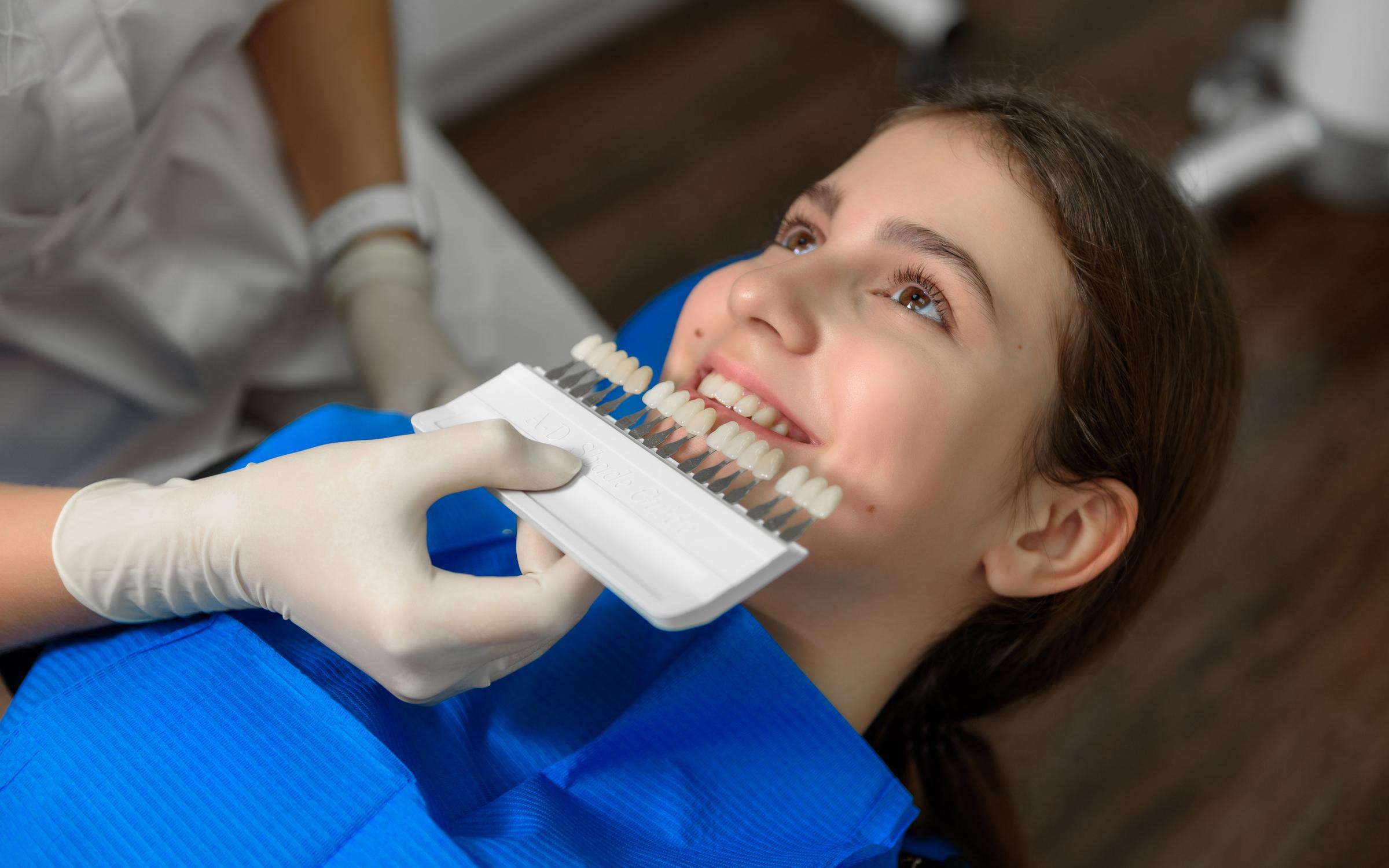 отбеливание зубов в стоматологии уфа