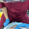 фото от пользователя Андрей в отзыве о клинике пересадки волос FUE Clinic