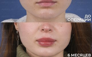 фотография работы врача Марии Григорьевны Бурлова (Левицкая)
