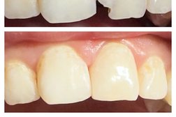 Стоматологическая клиника КолибриДент, с рейтингом 5 - находится по адресу Московская область, Ленинский городской округ, Видное, Битцевский проезд, 1 