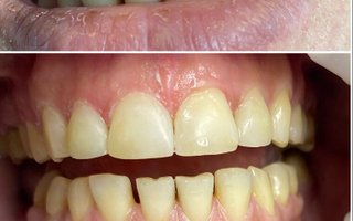 фотография работы врача Ольги Михайловны Бутурлимовой
