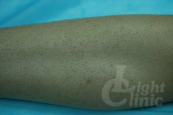 Клиника эстетической медицины Light Cliniс, с рейтингом 3.2 - находится по адресу Самара, Георгия Димитрова улица, 117 