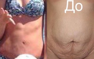 фотография работы врача Галины Юрьевны Феденко