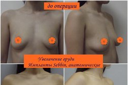 Клиника пластической хирургии Надиалан Aesthetic, с рейтингом 2.7 - находится по адресу Алматы, Байкадамова, 3 