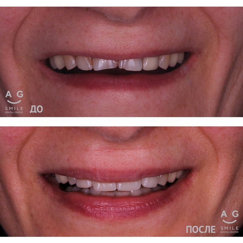 фотография работы Стоматологии AG-Smile на Новой Басманной улице