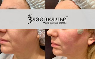 фотография работы врача Анжелики Викторовны Хешы