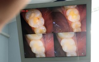 фотография работы врача Артака Меружановича Аветисяна