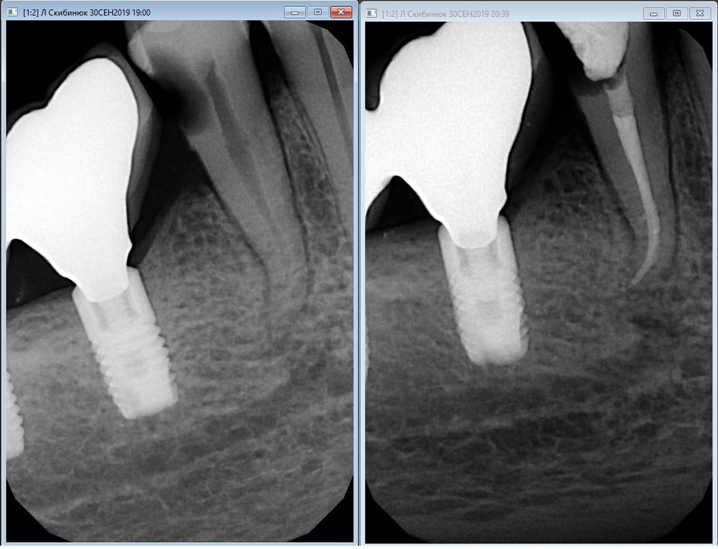 фотография работы Стоматологической клиники Eclinic на улице Дыбенко