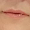 фото от пользователя Юлия в отзыве о центре медицинской косметологии Beauty Сlub на Школьной улице