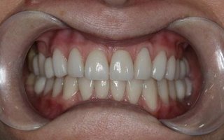 фотография работы врача Сергея Анатольевича Лабаня