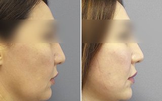 фотография работы врача Марины Анатольевны Четвериковой