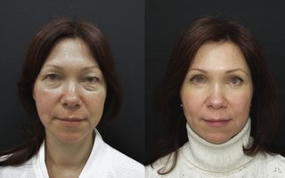 фотография работы врача Андрея Евгеньевича Копасова