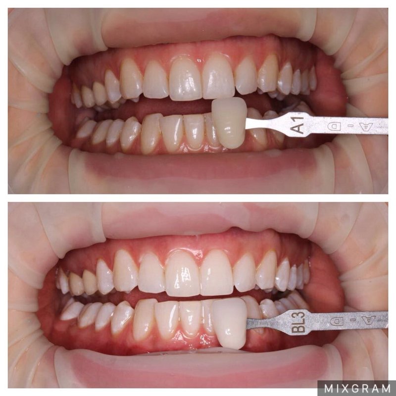 фотография работы Стоматологической клиники Smile Design на улице Ленина
