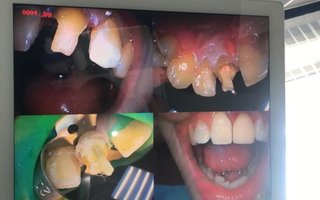 фотография работы врача Артака Меружановича Аветисяна